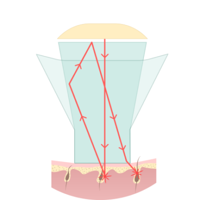 Ilustracja systemu luster w laserze Vectus